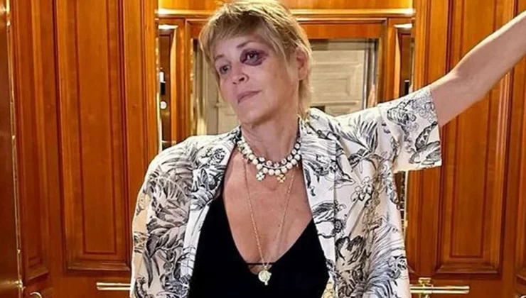 Sharon Stone, tuvalette kaza geçirdi